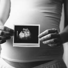 Pregnant woman holding echography of her baby.